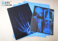 Filme azul da imagem latente médica do Inkjet do ANIMAL DE ESTIMAÇÃO da baixa névoa 8 x 10 polegadas para a impressora de Epson