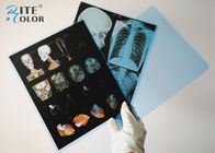 Impressoras azuis da imagem latente médica X Ray Film For Canon Pixma do ANIMAL DE ESTIMAÇÃO do Inkjet