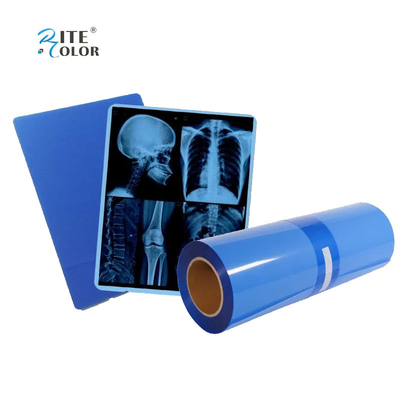 IMATEC Blue PET Inkjet Medical CR Film de Radiografia de Raios X Para impressoras Canon