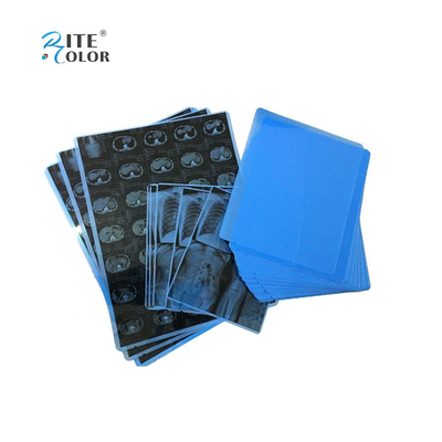 Impressão a jato de tinta PET Filme médico azul para raios-X A4 8x10 14x17 folhas