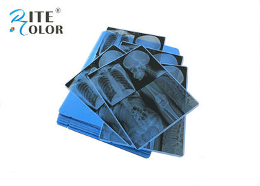 Material sensível azul médico do ANIMAL DE ESTIMAÇÃO do filme de X Ray para a impressão do Inkjet da imagem