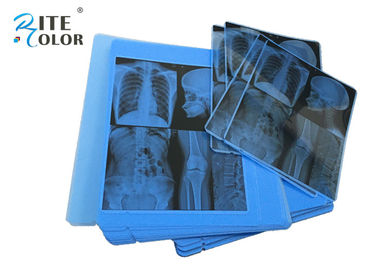Espessura azul do filme 210um da imagem latente médica de X Ray da radiologia para a impressora a jato de tinta de Epson
