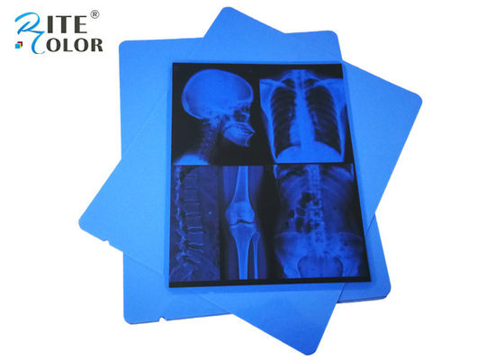 Filtro de raios X Médico A4 Azul PET Pigmento Seco Jato de tinta 210 Microns Eco-friendly