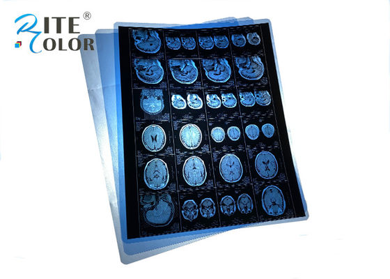 Película de raios X médica PET azul à prova d'água para ressonância magnética CT CR